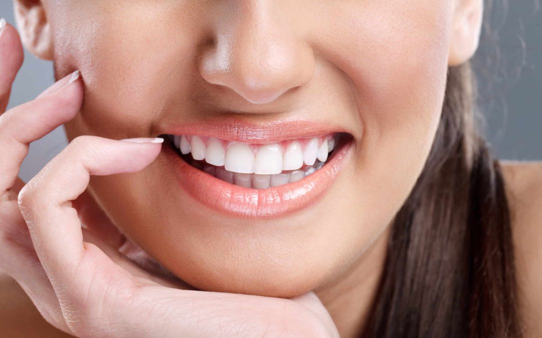 Is Teeth Whitening Permanent?