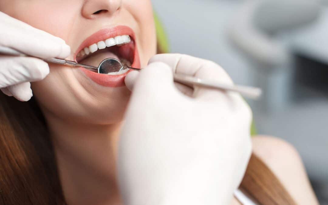 What Is the Cost of a Dental Check-up and Cleaning in Albany Creek?